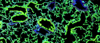 Microscope image of a rescued lung.